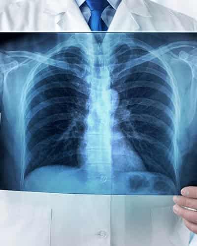 X-Ray Services Near Me in Columbia, MD
