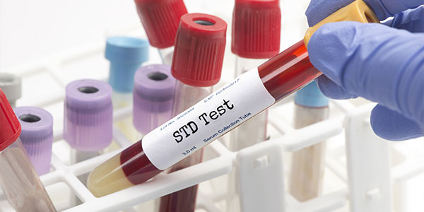 Why Is STD Testing Important for Maintaining Sexual Health? | Elite Urgent Care in Columbia MD