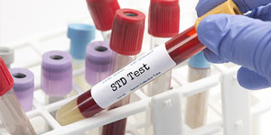 Why Is STD Testing Important for Maintaining Sexual Health? | Elite Urgent Care in Columbia MD