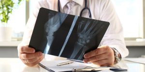 Urgent Care with X-Ray: A Convenient Option for Quick Diagnoses in Columbia MD
