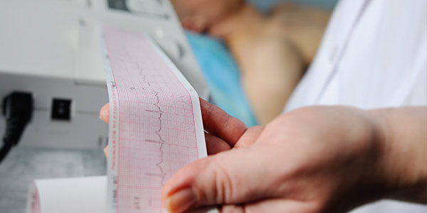 What Should You Expect Before, During, and After an EKG in Columbia, MD?