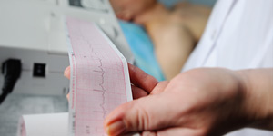What Should You Expect Before, During, and After an EKG in Columbia, MD?