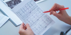 What Factors Influence the Price of an EKG Test in Columbia MD?
