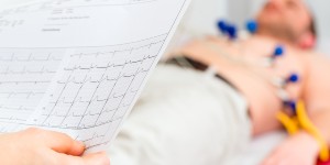 How Much Does an EKG Test Cost at an Urgent Care Clinic in Columbia MD?
